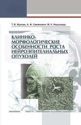 Клинико-морфологические особенности роста нейроэпителиальных опухолей 7068646 фото