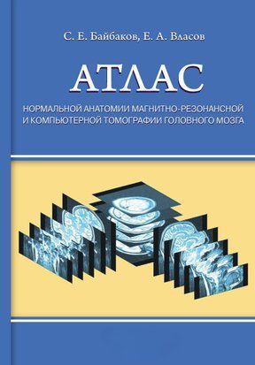 Атлас нормальной анатомии магнитно-резонансной и компьютерной томографии головного мозга 10099274 фото